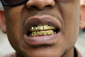 famous rapper emcee wearing fronts